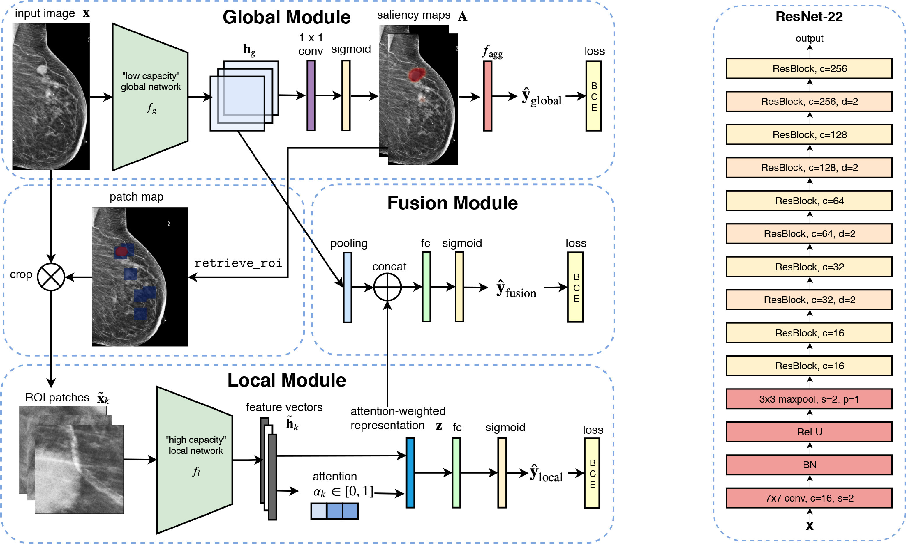 Publication Image for An interpretable classifier for high-resolution breast cancer screening images